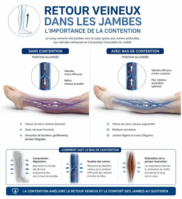 Schéma explicatif du fonctionnement des bas de contention après une opération chirurgicale pour prévenir la stase veineuse