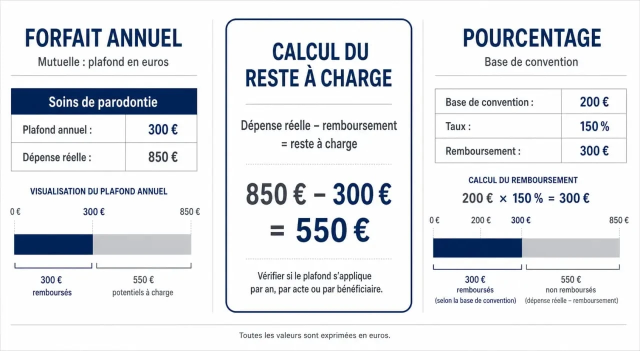 Parodontie mutuelle : forfait annuel, pourcentage et reste à charge